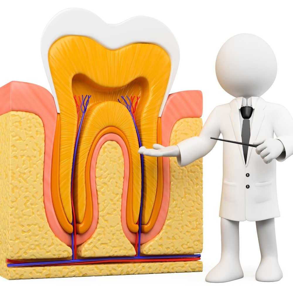 Root Canal Treatment (RCT)